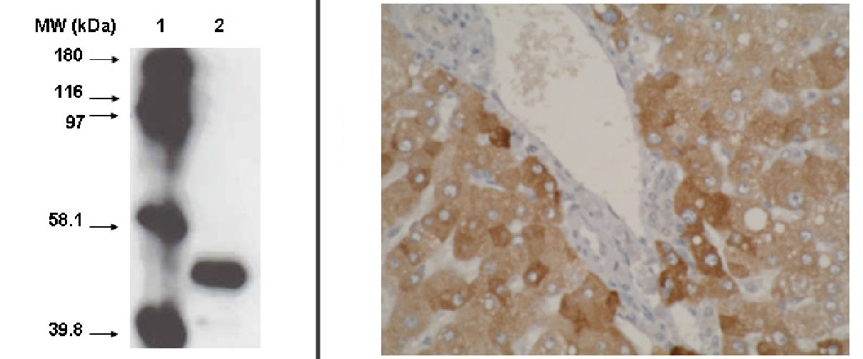 "Left: Western blot using CYP2A6 antibody (Cat. No. X2045M) on recombinant cytochrome p450 at 1 µg/ml.
Right: Staining using CYP2A6 antibody on normal human liver tissue at 1 µg/ml."
